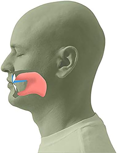 Nose Breathe® Trainer - Experience The Benefits of Nasal Breathing - Correct Tongue Placement, Tongue Position at The Roof of The Mouth, Will Stop Mouth Breathing Naturally.