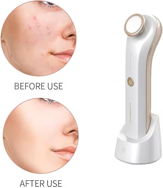 KinseiBeauty Plasma Facial Device, Ozone Skin Care Machine, Face Massager for Acne Treatment, Brightening, Anti-Wrinkle