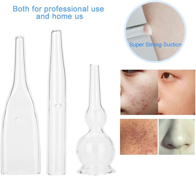 3pcs Vacuum Glass Tube Kit, Blackhead Removal Facial Suction Pore Vacuum Cleaner for Face Cleanser Blackhead Removal Machine Microdermabrasion Machine Accessories