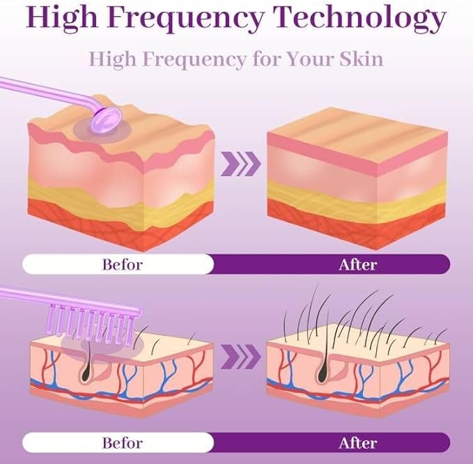 High Frequency Facial Wand - TUMAKOU Violet Portable Handheld High Frequency Facial Skin Machine Device for Face - with 4 Purple Tubes（Violet）
