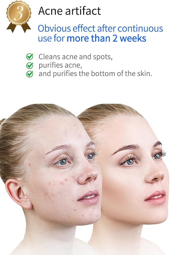KinseiBeauty Plasma Facial Device, Ozone Skin Care Machine, Face Massager for Acne Treatment, Brightening, Anti-Wrinkle