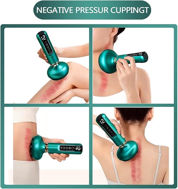 Intelligent Handheld Massage Tool for Anti - Cellulite, Electric Cupping Device with 12 Suction Modes. This Fat Remover Massager is suitable for Arms, Legs, Back and can be Used at Home. (white)