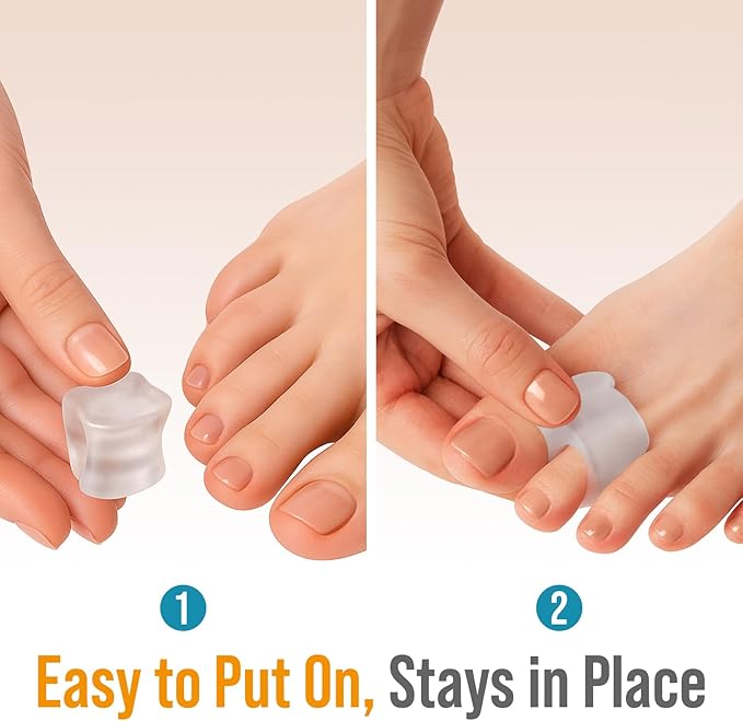 5 STARS UNITED Big Toe Spacers for Men & Women – 6 Gel Separators for Overlapping & Curled Toes, Bunions, Alignment - Diabetic Foot Care, Silicone Spreader, Corrector & Straightener, Clear