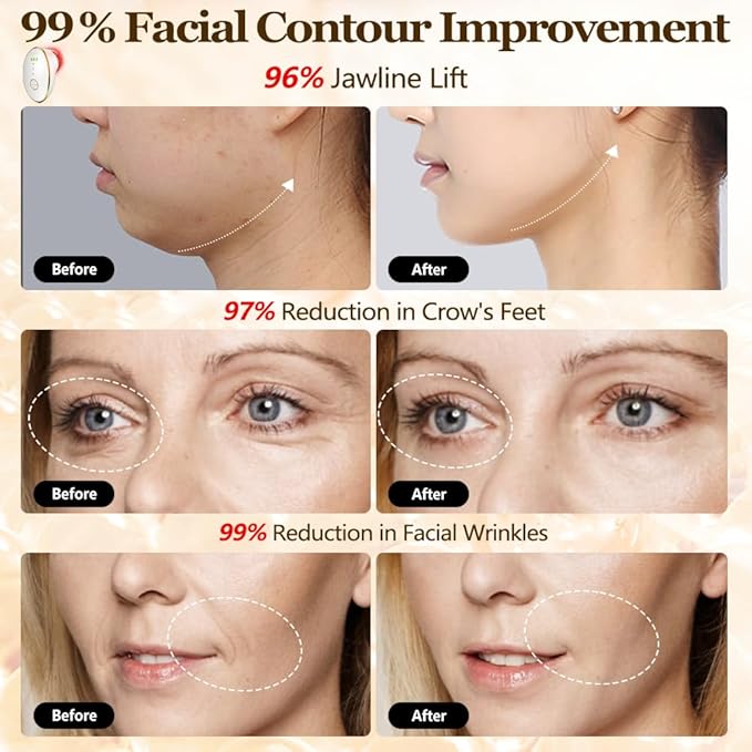 Facial Cupping Set for Face, 3 in 1 Microcurrent Facial Device, 7 Color LED Lymphatic Drainage Massager for Face Skin Tightening & Depuffing, Double Chin Reducer