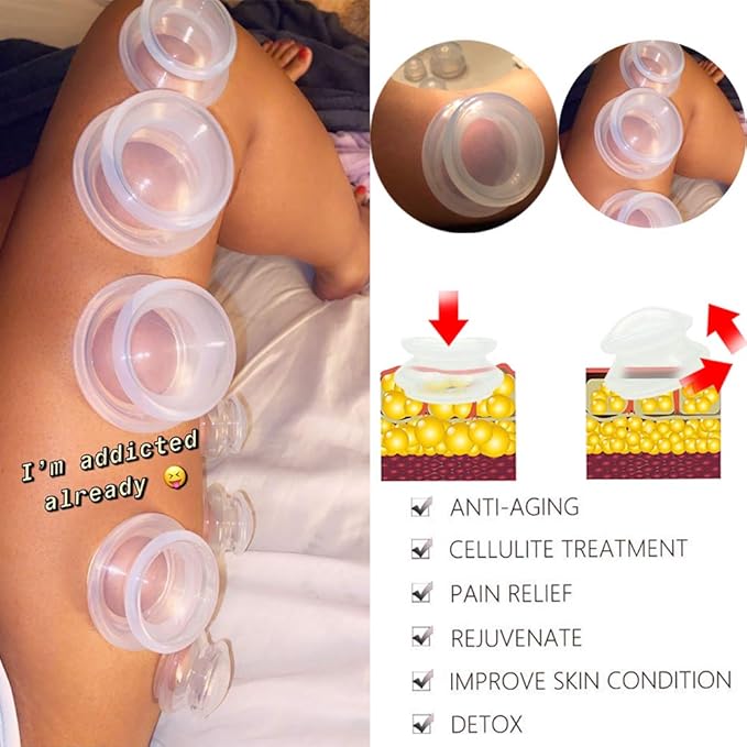6 Sizes Cupping Therapy Set-Professional Cupping Therapy Studio and Household Silicone Cupping Set, Stronger Suction, Suitable for Myofascial Massage, Muscle, Nerve, Joint Pain