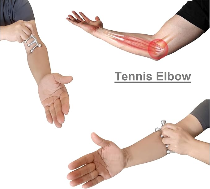 Tennis Elbow Massage Tool, Upper Arm Massage Tool, Myofascial Release Trigger Point Massager (Large)