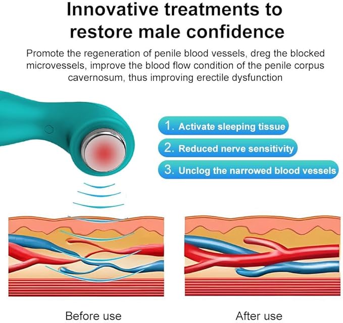 Portable Silent Shockwave Therapy Machine, Effective Electromagnetic Extracorporeal E-D Shock Wave Therapy Machine Pain Relief Body Massager Muscle Relax Massage Gun