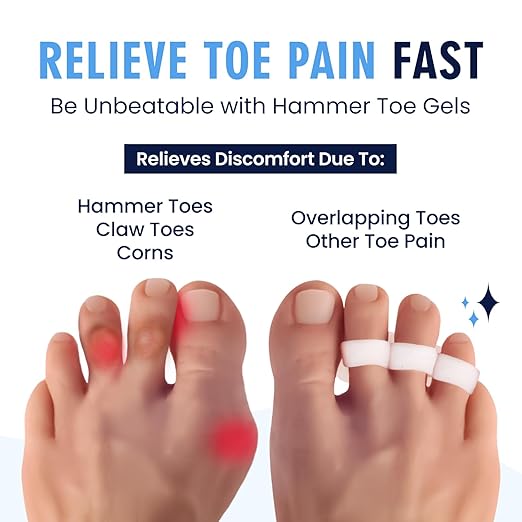 Dr. Frederick's Original Hammer Toe Corrector Gels - 2 Pairs - All-Day Relief for Crooked & Overlapping Toes - Soft Cushioning - Symptomatic Support for Toe Alignment - White - 3 Loop Design