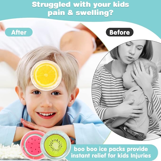 Hilph Kid Ice Packs, Reusable Boo Boo Ice Packs for Kids & Toddlers & Baby Injuries, Hot Cold Compress for Body Pain Relief, Bumps & Bruises, Toothache, Fever, 4.5 Inch, 3 Packs, Fruit