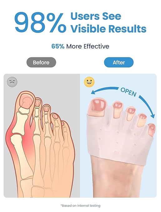 Toe Separators for Women - Podiatrist Recommended, Toe Spacers for Men, Breathable Bunion Corrector, Plantar Fasciitis(1 Pair)