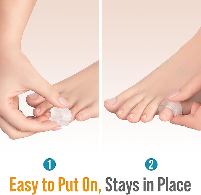 5 STARS UNITED Pinky Toe Spacers for Men & Women – 4 Gel Separators for Overlapping & Curled Little Toes, Bunions, Alignment - Diabetic Foot Care, Silicone Spreader, Corrector & Straightener, Clear
