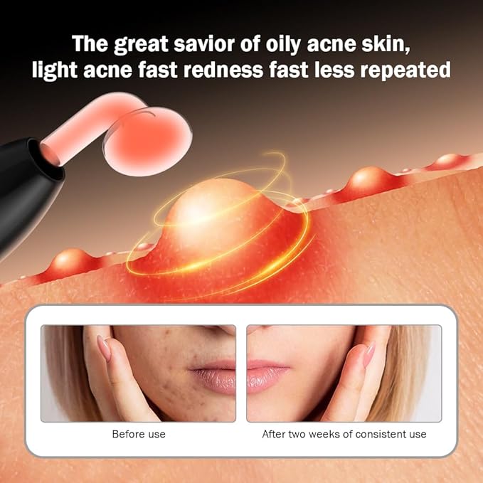 OxyGlow2 Cordless High Frequency Facial Machine - ProFacial Wand Clinical Skin Therapy Wand - Neon+Argon Gas (Onyx Black)