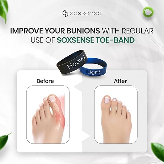Soxsense Toe Stretcher Bands - Toe Spacers for Bunion Correction, Hallux Valgus Corrector, Foot Stretcher Resistance Band for Bunion Relief 2 PCS