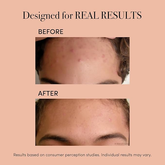 ReVive Clinical Acne Device, Red & Blue Light Wand for Breakouts, FDA-Cleared Acne Tools, 3-Minute Face Tools for Skincare, Plug-In Design