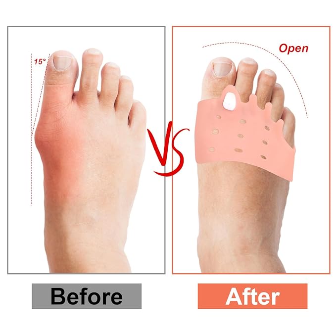4 Pairs Silicone Toe Separators for Women & Men, 4 Colors Correct Spacers Orthotic Pads Soft Breathable Comfortable Gel Foot Pad for Straighten Overlapping Toes & Foot Alignment Tool