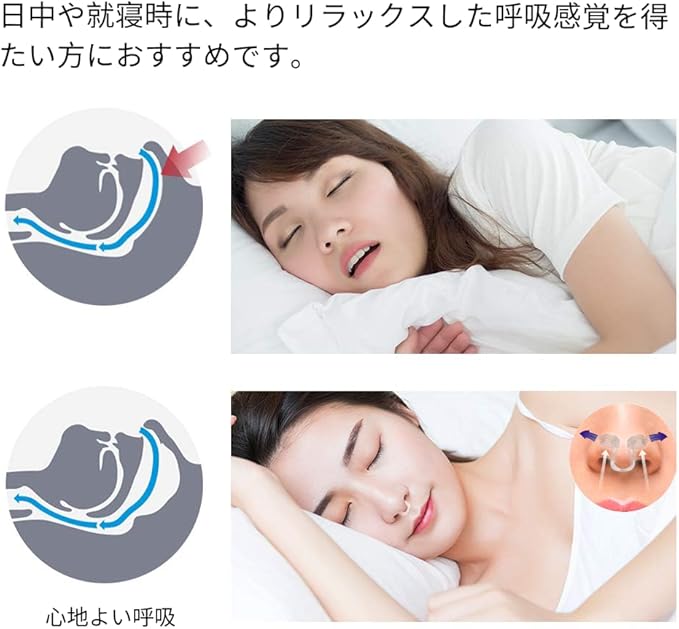 WoodyKnows Super-Support Nasal Dilator, Improves Sleep and Sports Airflow, Nasal Congestion and Nose-Related snoring aid (XS 4Pack)