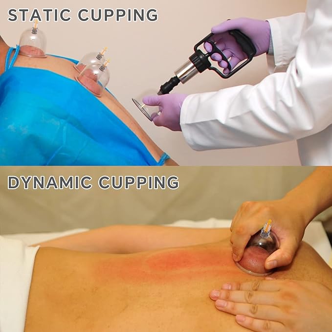 Cupping Set Massage Therapy Cups Cupping Kit for Body Cellulite 24 Suction Cups