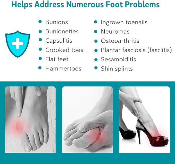2 Pairs Toe Spacers Bunion Corrector for Women/Men, Foot Alignment - Spreaders for Bunions, Hallux Valgus, Support Foot Fitness and Balance