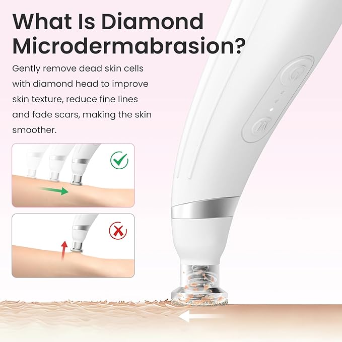 UNOISETION Diamond Microdermabrasion Machine, Portable Blackhead Remover Pore Vacuum, Dermabrasion Facial Machine for Exfoliation & Blackhead Removal