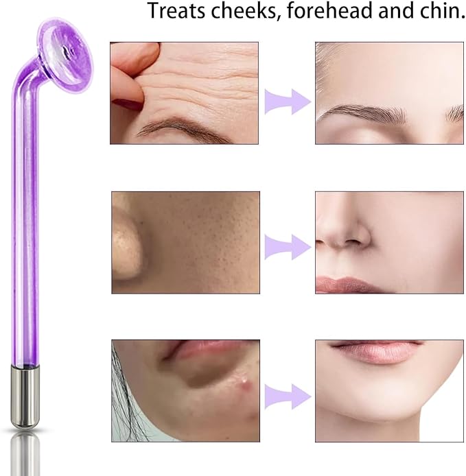 Spare Parts Mushroom for Handheld HIF Facial Hair Device Facial Care Orange Purple Blue Color Glass Tube Electrode Elitzia ETJX0066 (Purple)