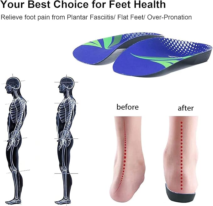 RooRuns FitFeet Orthotic Inserts 3/4 Length, High Arch Support Foot Insoles for Over-Pronation, Plantar Fasciitis, Flat Feet - Shoe Inserts for Walking, Running Men and Women