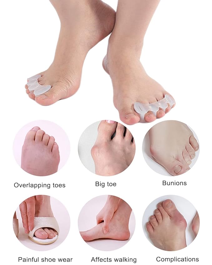 2Pairs Toe Separators Toe Spacers for Women Men to Correct Bunion, Relieve Feet Pain, Foot Alignment, Toe Straighteners for Hammertoes, Plantar Fasciitis (S, Women Shoe Size: 6.5-9, Men: 6-7)