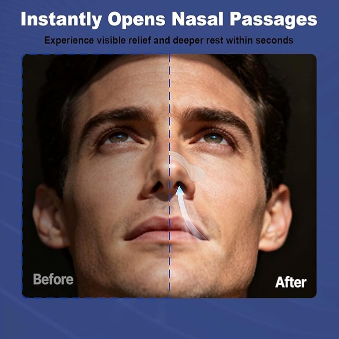Nasal Strips for Snoring – Comfortable Nose Strips for Breathing,Anti Snoring Devices,Skin-Friendly Snoring Solution for Better Airflow & Restful Sleep