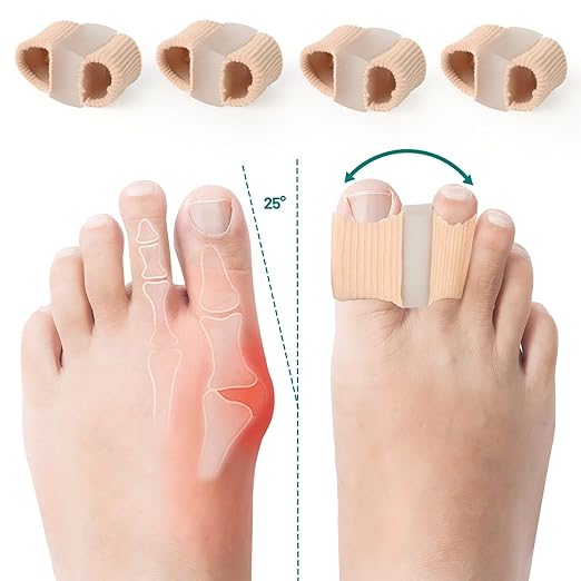 Bunion Corrector for Women Big Toe, Silicone Toe Separators for Women, Spacers Bunion Correctors for Overlapping Toes, Hammer Toes Straightener Alignment Relieve Foot Pain