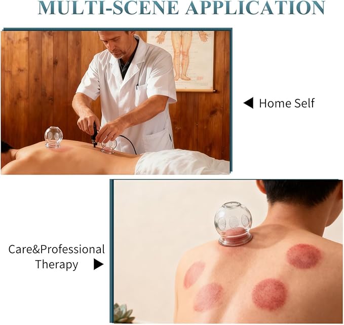 7 Pcs Glass Cupping Set with Finger Grips, Traditional Chinese Fire Cupping Therapy Jars for Back Muscle Tension Relief, Ventosas para Masaje Muscular (2.36X2.16X2.16In)