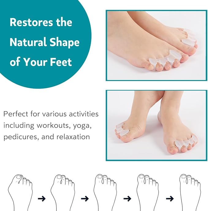 2 Pairs Toe Spacers Bunion Corrector for Women/Men, Foot Alignment - Spreaders for Bunions, Hallux Valgus, Support Foot Fitness and Balance