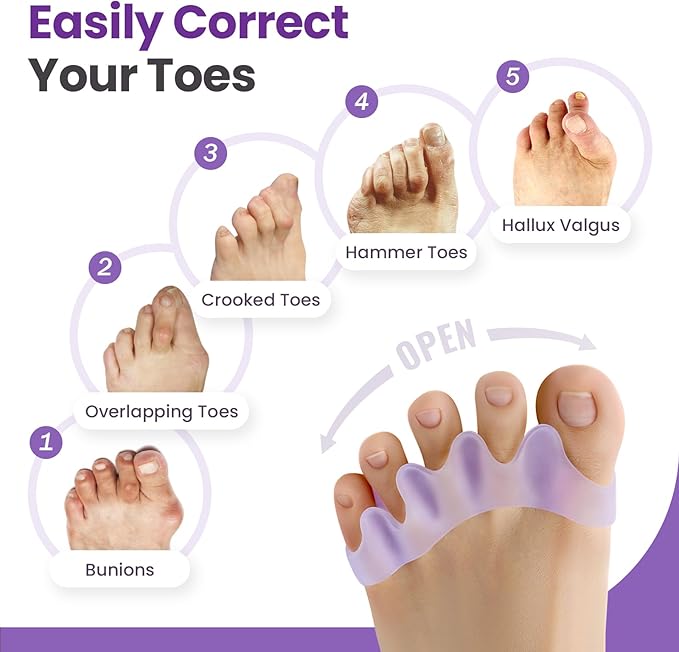 Toe Separators, 8 Pack Bunion Corrector for Women/Men, Soft Toe Spacers with Lavender Extract - Dividers to Correct Bunions, Hammertoes, Overlapping Toes (Lavender)