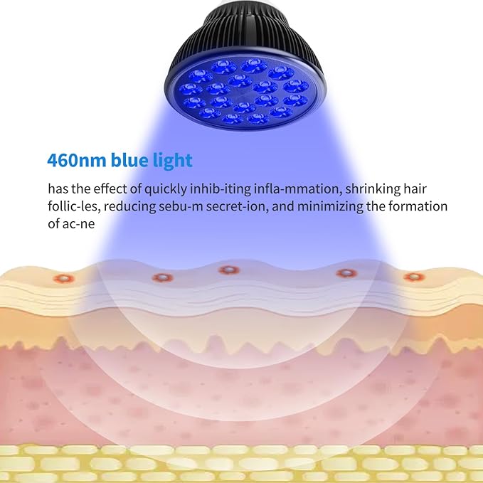 Blue Light Therapy Bulb, 18 LEDs Blue Light Therapy Lamp for Face and Body, High Irradiance, Large Coverage Area (Only Bulb)