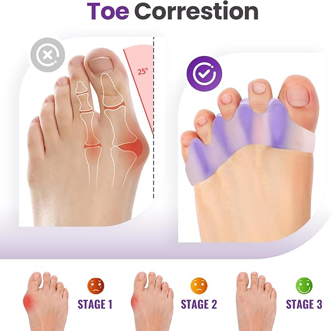 Toe Separators, 8 Pack Bunion Corrector for Women/Men, Soft Toe Spacers with Lavender Extract - Dividers to Correct Bunions, Hammertoes, Overlapping Toes (Lavender)