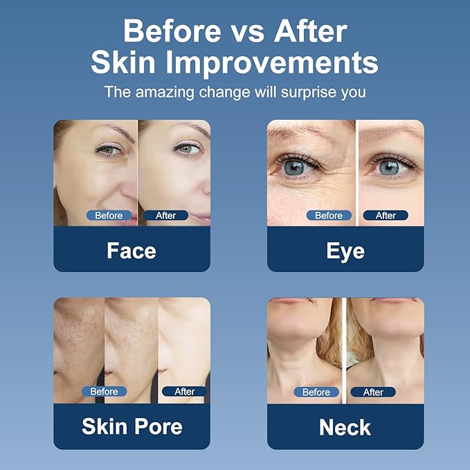 MiSMON High Frequency Facial Machine, 5 in 1 Mutifunctional Facial Massager Skin Tightening Light Theraphy Machine for Face