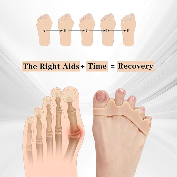 Big Toe Spacers,Toe Separators for Women & Men,Bunion Corrector,Yoga Toes Gel, Foot Pain Relief and Health,1 Pair Each