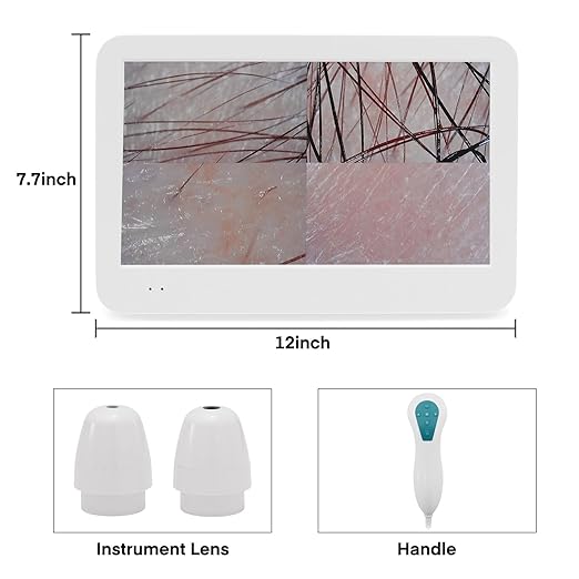 Beauty Star Scalp Analysis Machine, 12 inches Skin Tester Diagnosis Digital Analyzer Tool, Profesional Hair Detector Microscope, HairFollicle Health Detection Camera for Head Spa, Salon and Home Use