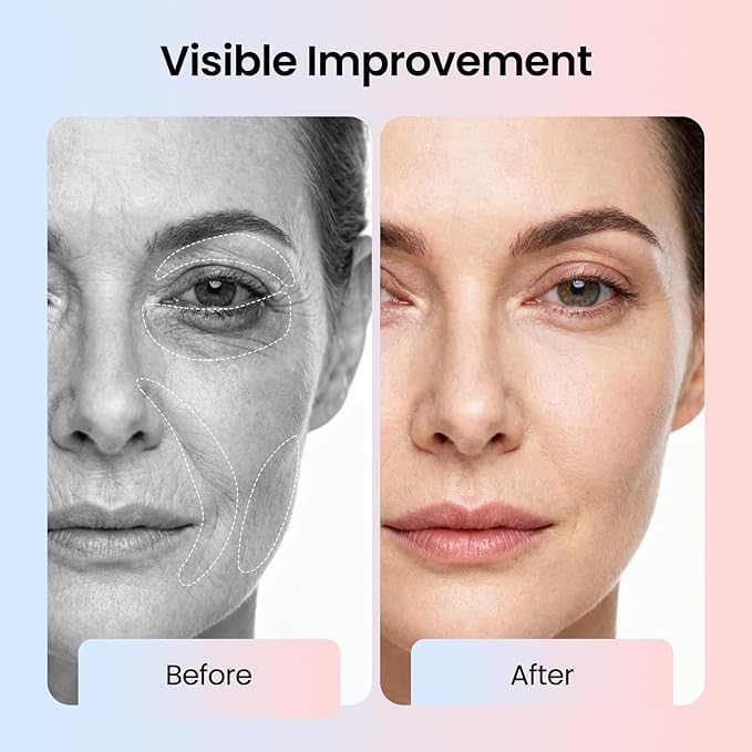 Radiant Renewal Skincare Wand – HD-44 Face & Eye Massager for Depuffing, Dark Circles, and Glowing Skin | Heat & Cooling Therapy, Facial Roller, Eye Care Tool for Women