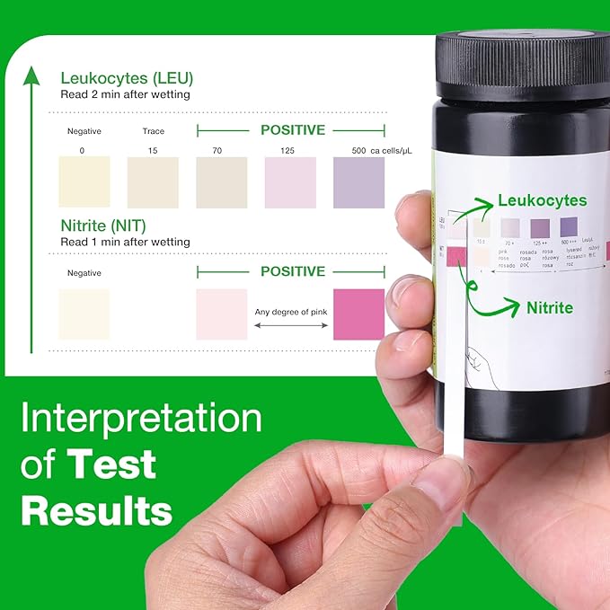 Easy@Home 50ct UTI Infection Test Strips, at Home UTI Urinalysis Testing Strips for Women Urinary Tract Bladder Health, Highly Accurate Urine Testing (UTI-50Pcs)