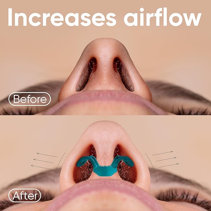 Brison Nasal Dilators for Breathing and Sleeping - 3 Pack Anti Snoring Nose Vents Opener for Better Breathing Sleeping and Activity Improves Airflow - Soft