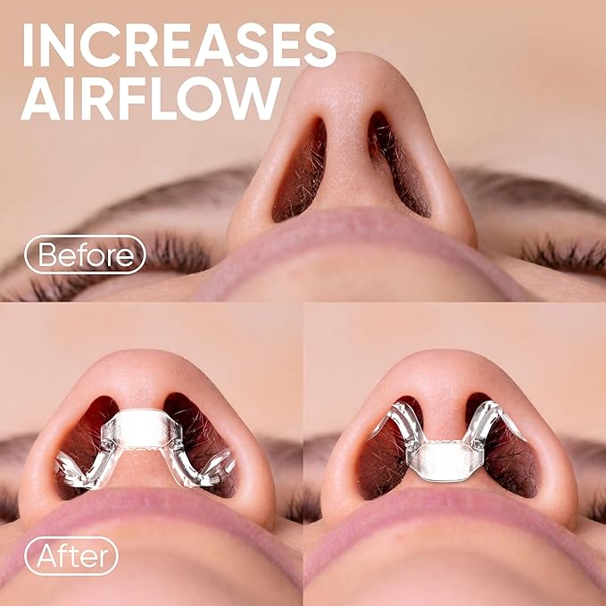 Brison Nasal Dilators for Breathing and Sleeping 3 Pack Anti Snoring Nose Vents Better Sleep Easier Breath Stuffy Nose Relief Airflow Expander Nostril Opener Soft