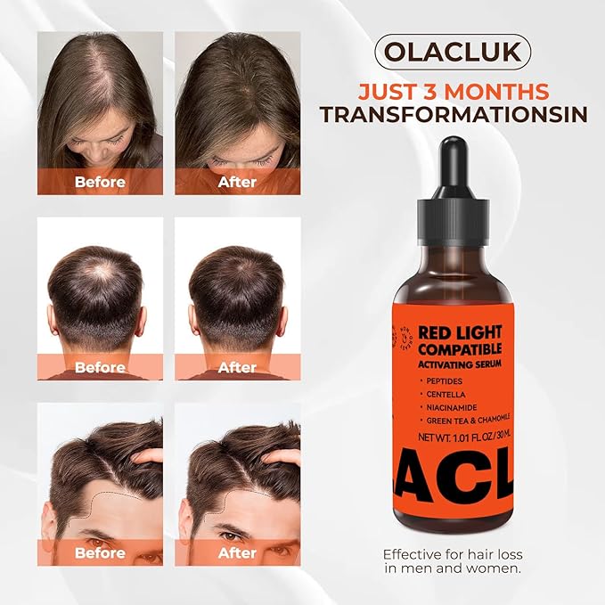 Red Light Therapy Hair Growth Serum - Copper Peptide Scalp Serum for LED Light Therapy Cap, Anti Hair Loss Treatment – Promotes Thicker, Fuller, Stronger - For Women & Men - 30ML