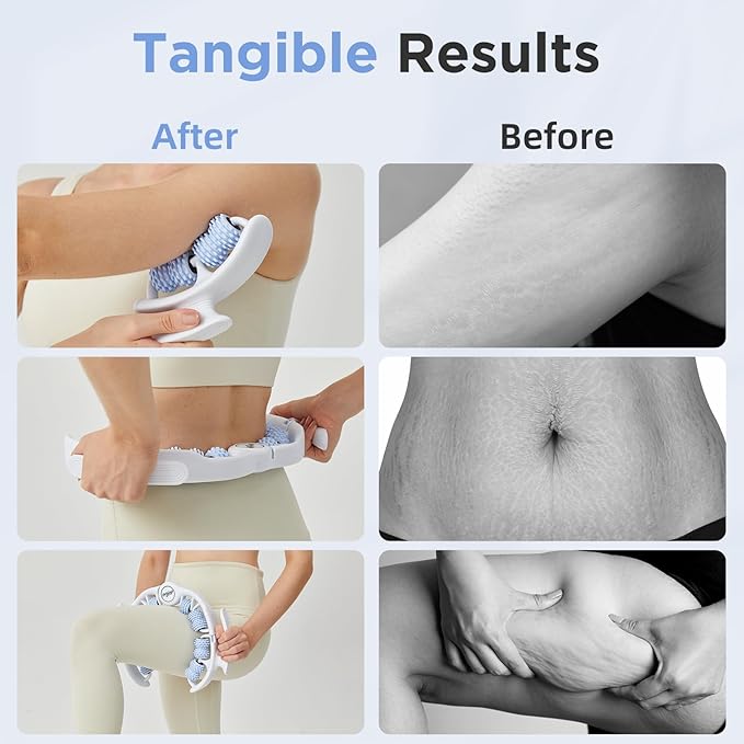 Cellulite Manual Massager for Legs & Thighs - Lymphatic Drainage Tool, Handheld Fascia Blaster for Deep Tissue, Body Sculpting Cellulite Remover(Blue)