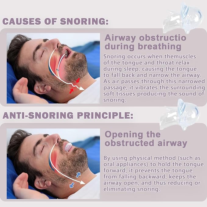 Snoring Solution - Anti-Snoring Devices, 2Pack Snore Device Stopper for Men and Women - H89