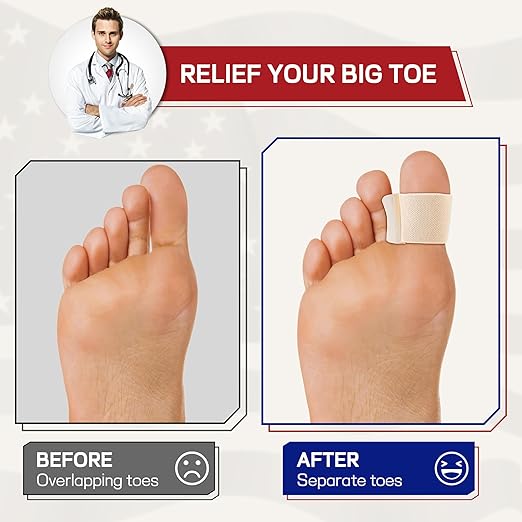 Orthopedic Gel Toe Separators for Overlapping Toes,Big Toe Spacers for Hallux Valgus Corrector with Shock Absorption, All-Day Comfort for Men & Women.