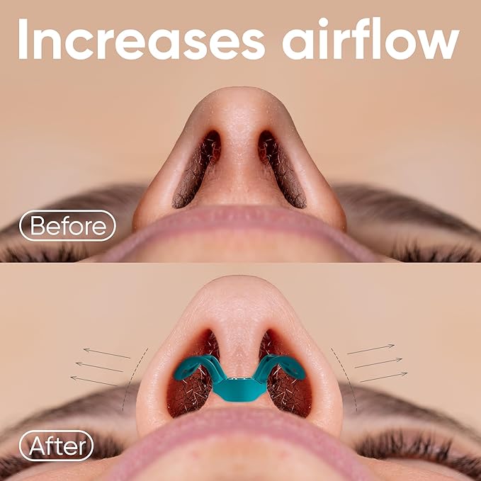 Brison Nasal Dilators for Breathing and Sleeping - 2 Pack Anti Snoring Nose Vents Opener for Better Breathing Sleeping and Activity Improves Airflow - 2pcs Soft-Hard