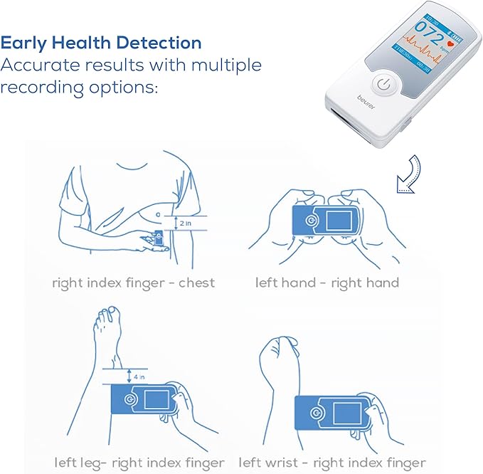 Beurer Cardio Companion EKG Monitor - 3-Lead Portable ECG Machine, Detects Irregular Heart Rhythms, Fast Results in 30 Seconds, Bluetooth with App, Rechargeable Battery, FSA/HSA Eligible, ME75