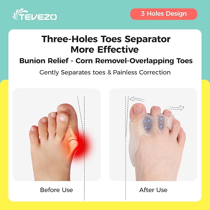 Toe Spacers & Bunion Corrector for Men&Women|Corn Callus Removers|Hammer Toe Straightener|Bunion Relief|Overlapping Toes Separators|1 Pair (Large-Teens/Adults)