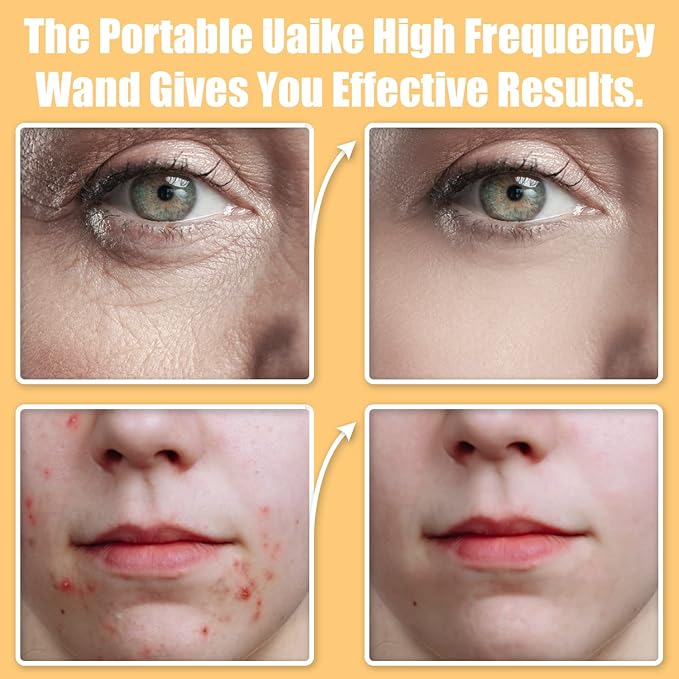 High Frequency Facial Wand - Uaike 6 in 1 Violet Portable Handheld High Frequency Facial Machine with 6 Pcs Purple Glass Tubes - at Home Face Skin Wand Device for Neck/Body/Hair/Face