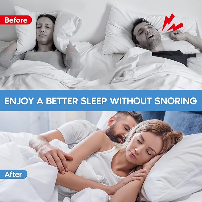 8pcs Anti Snoring Nose Vents Device That Work, Anti Nose Vents for Snoring Devices, Snoring Devices for Men, Nose Opener for Breathing Sleep, Stop Snoring Devices That Work for Men