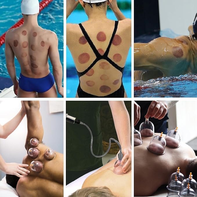 Cupping Set, 19 Cups Cupping Kit for Massage Therapy, Cupping Therapy Set with Pump for Back Massage, Pain Relief, Physical Therapy